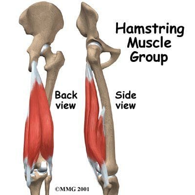 Chronic Proximal Hamstring Pain in a Runner